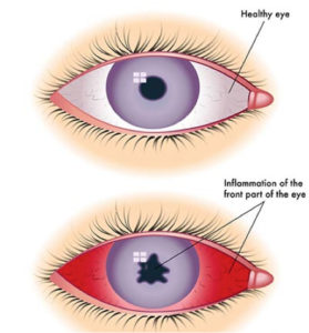 Ophthalmologist in Virgin Islands